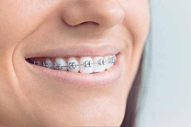 Best Dental Fillings (Composite and Amalgam)  in Bon Secour, AL